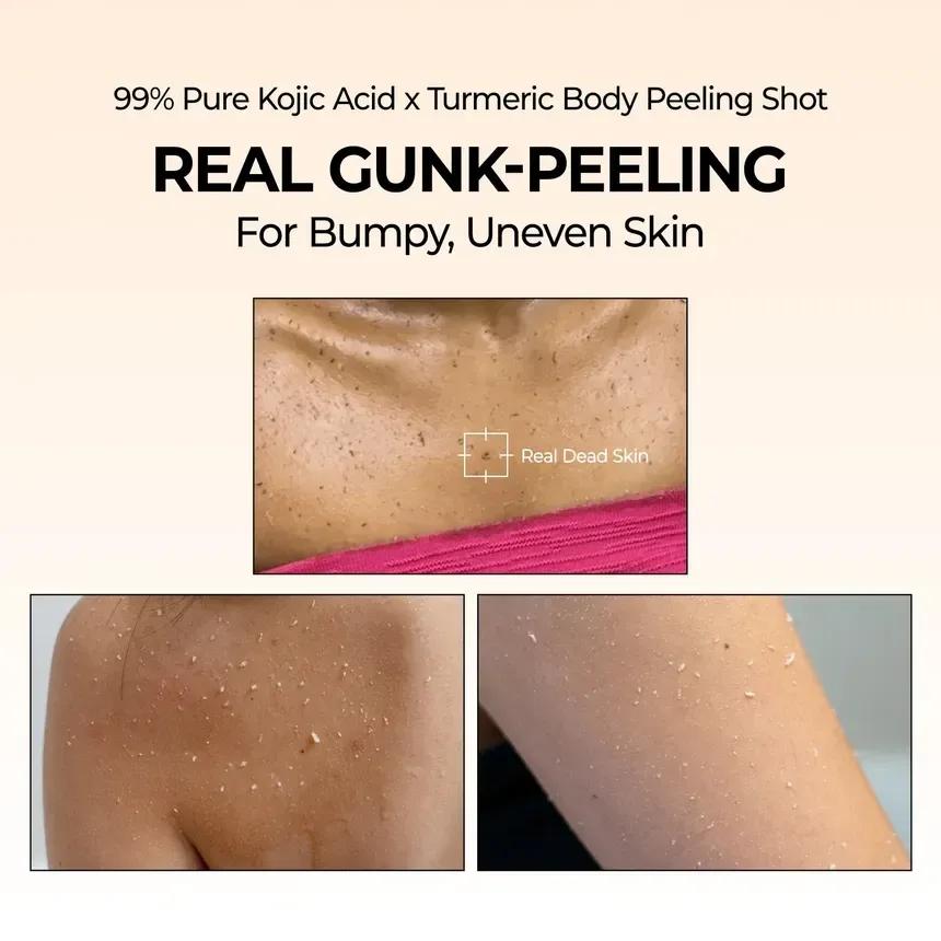 اسپری لایه بردار بدن دکتر ملاکسین Exfoliating Kojic acid حجم 200میل Dr Melaxin — تصویر ۳